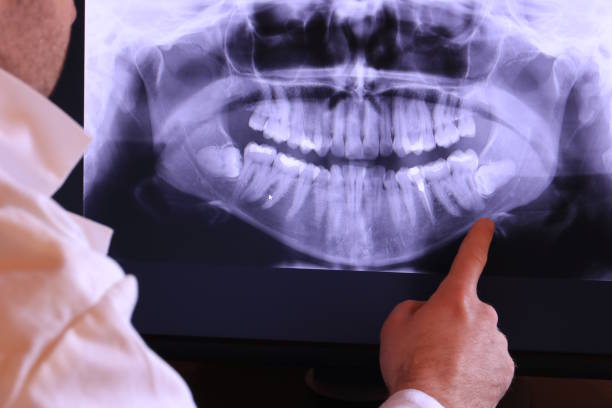 Best Emergency Treatment for Oral Infections in Manchester, KY