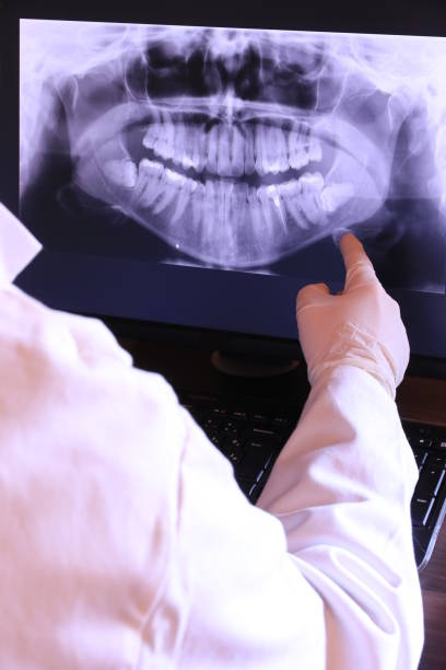 Best Emergency Dental Care for Sports Injuries in Manchester, KY